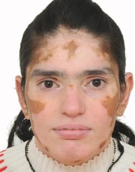 MARGI PATEL