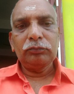 Nagarajah C
