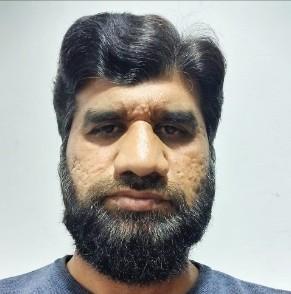 SYED ZUBAIR HUSSAIN