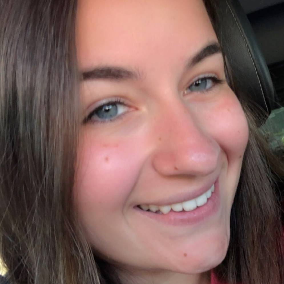 Ashlyn Glon